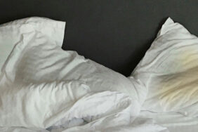 sararmis-yastiklari-5-dakikada-beyazlatan-dogal-yontem-avrupanin-yuzyillik-sirri