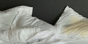 sararmis-yastiklari-5-dakikada-beyazlatan-dogal-yontem-avrupanin-yuzyillik-sirri