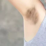 koltuk altı kararması