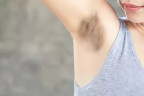 koltuk altı kararması