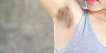 koltuk altı kararması