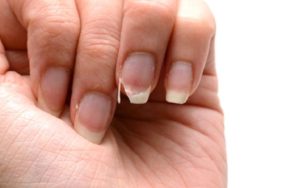 tırnak kırılması