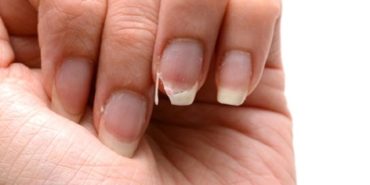 tırnak kırılması