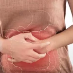 kalın bağırsak kanseri gençler