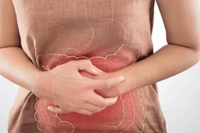 kalın bağırsak kanseri gençler